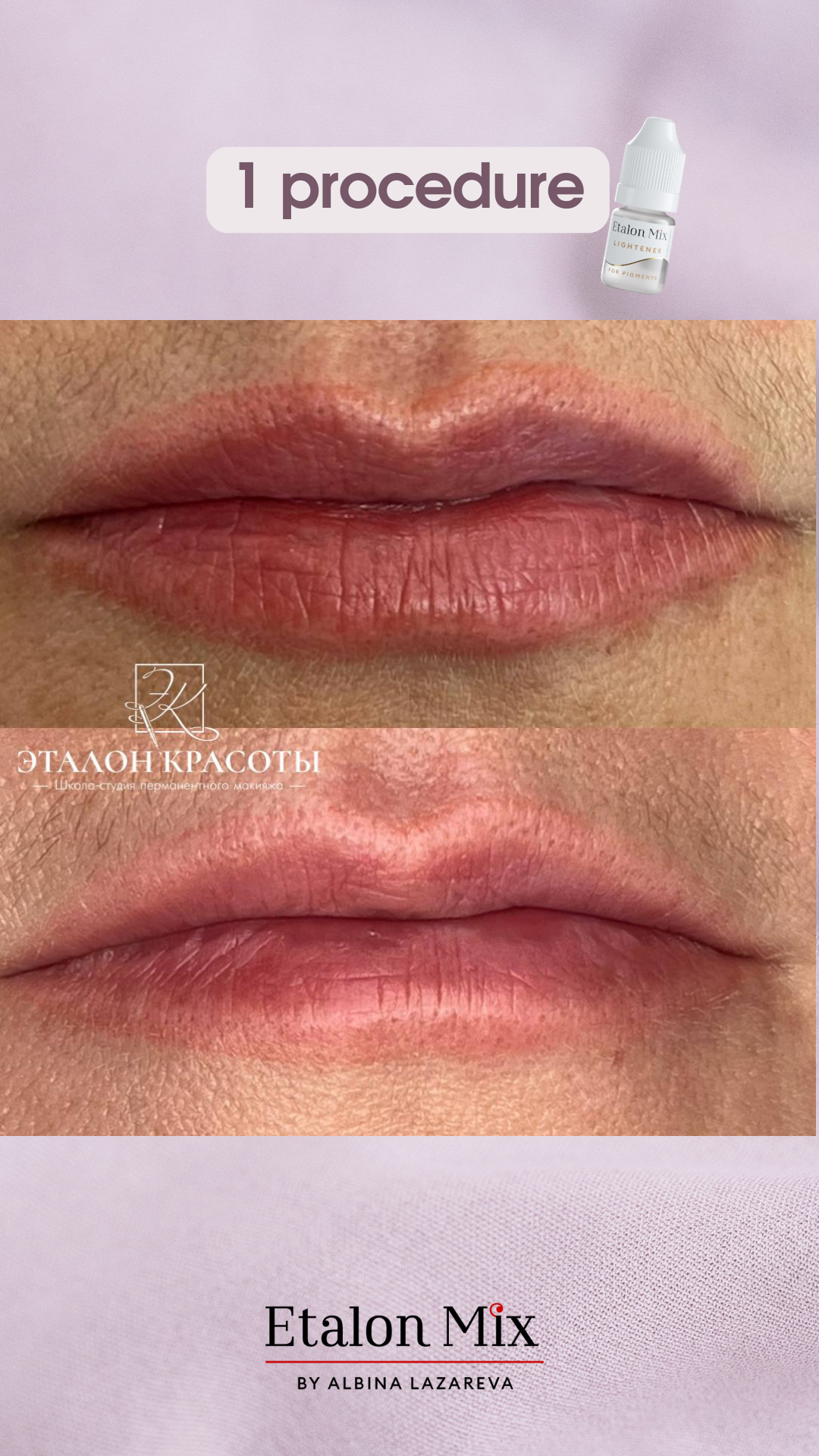 Etalonmix remover 5 ml