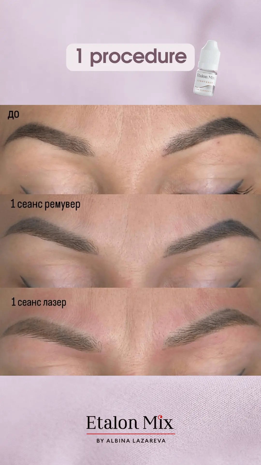 Etalonmix remover 5 ml